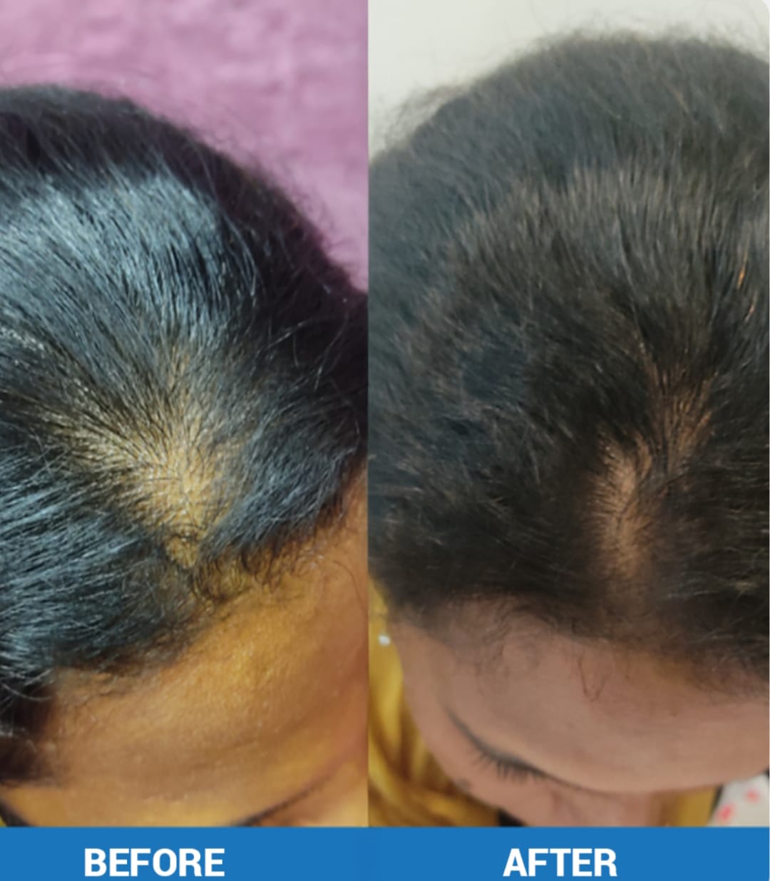 Hair Oil - 100ml