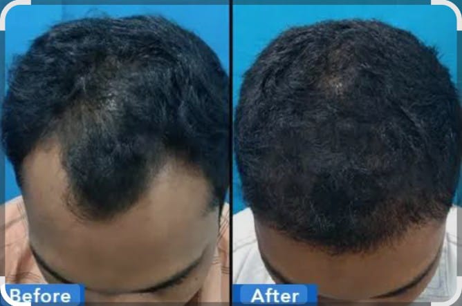Hair Oil - 100ml