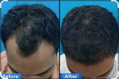 Hair Oil - 100ml