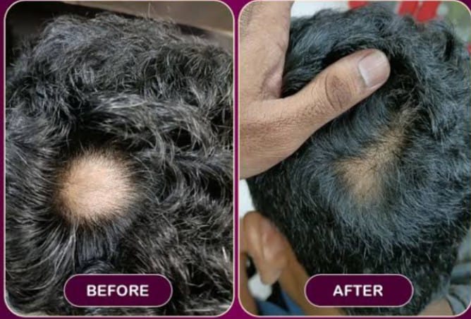 Hair Oil - 100ml